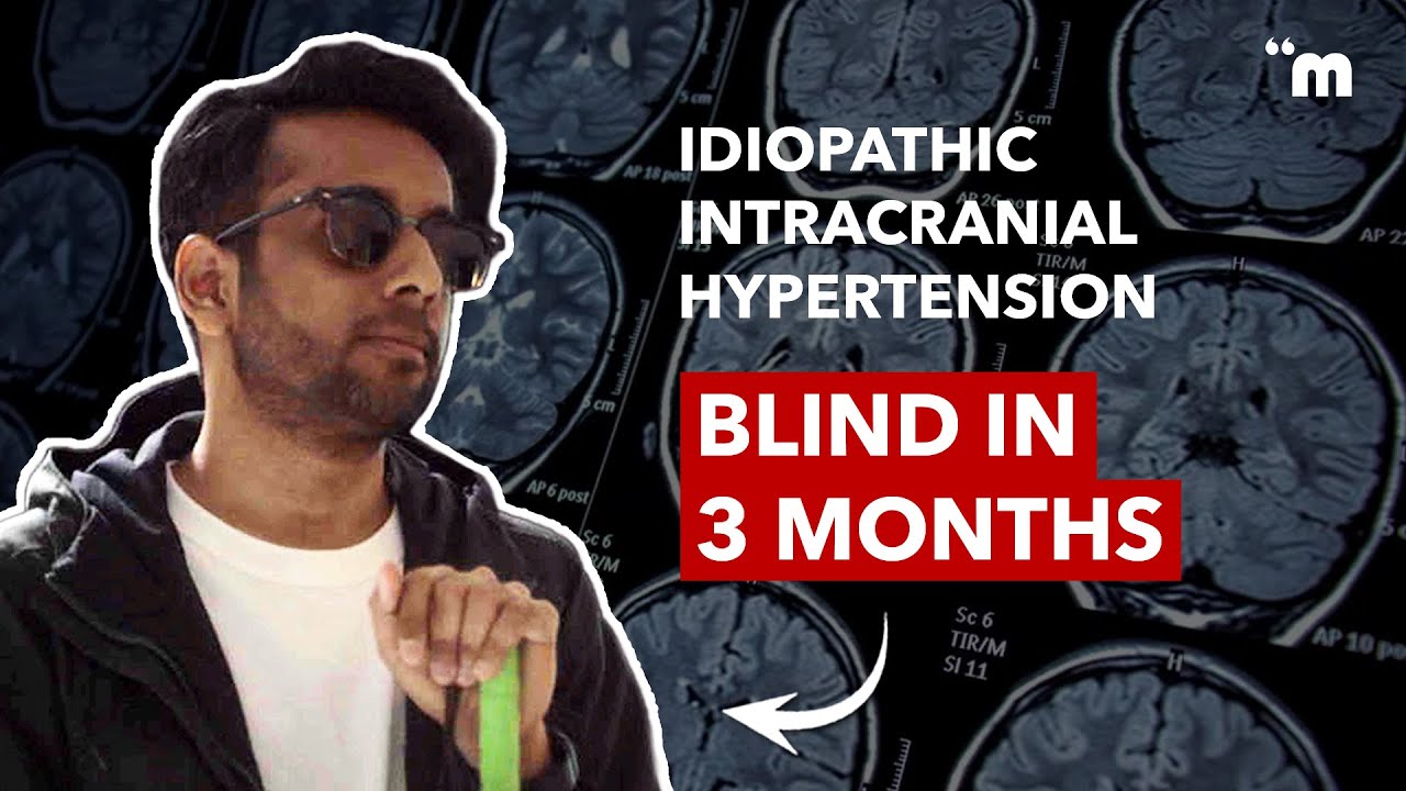Diagnosed with Idiopathic Intracranial Hypertension at 25
