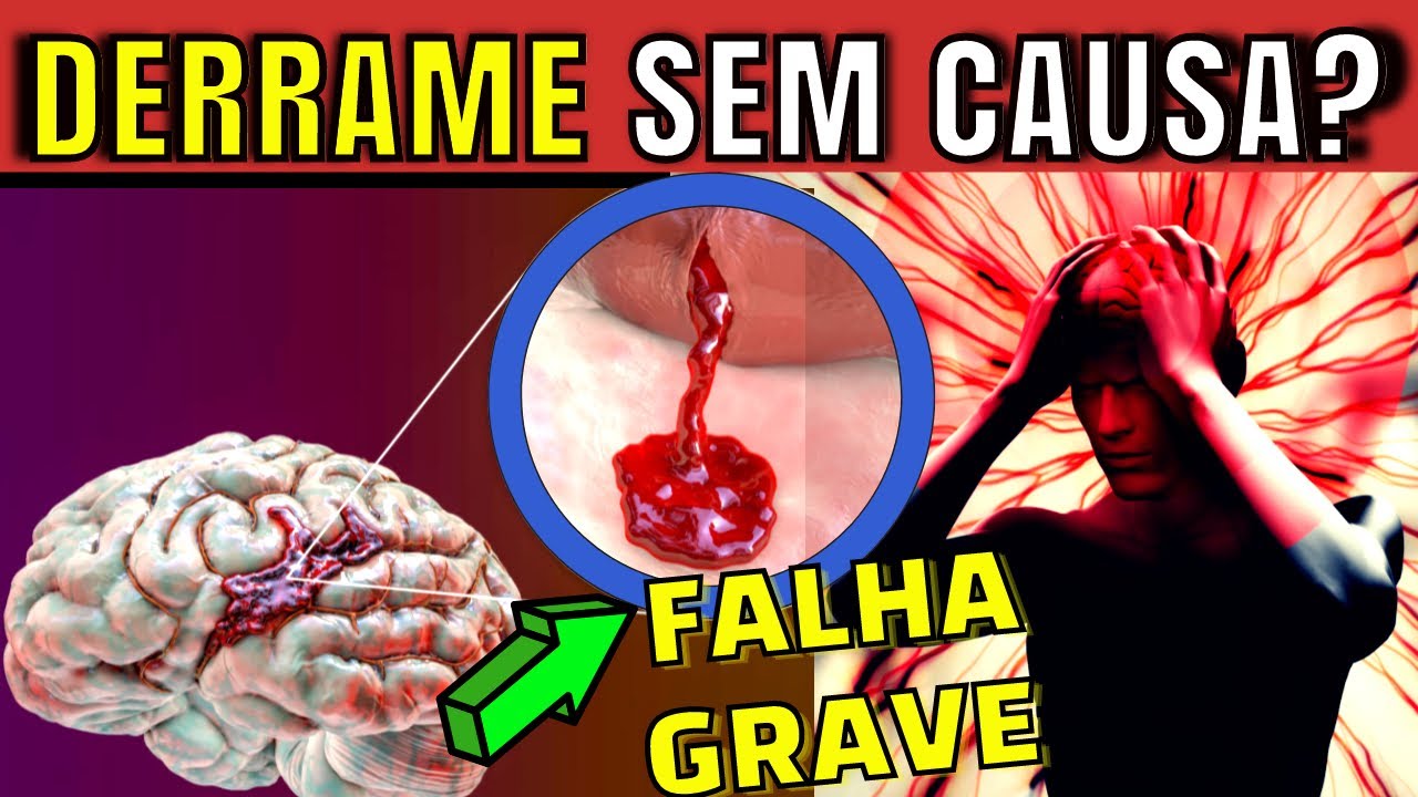 7 HÁBITOS que podem reduzir MUITO seu risco de ter um AVC (sintomas de derrame cerebral)