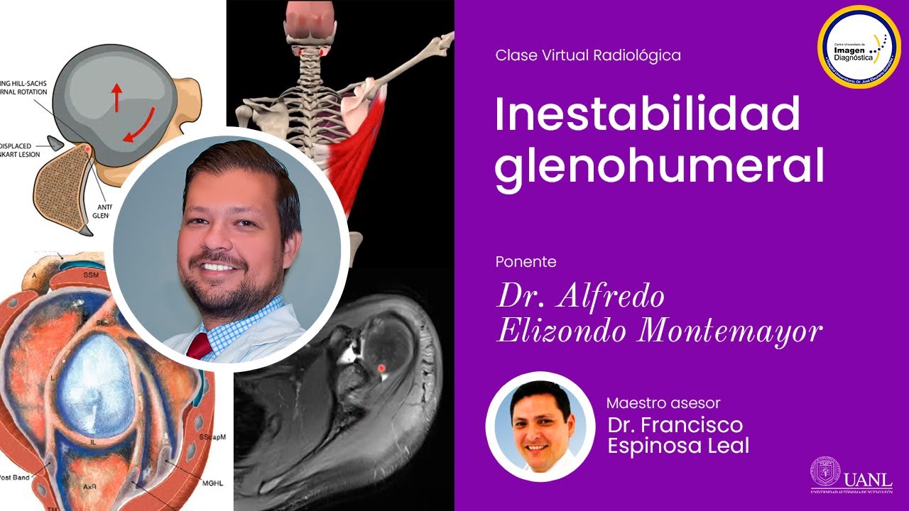 Inestabilidad glenohumeral