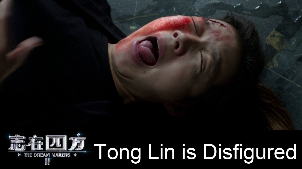 Tong Lin is disfigured - The Dream Makers 2 志在四方2 - Ep 28 Highlight