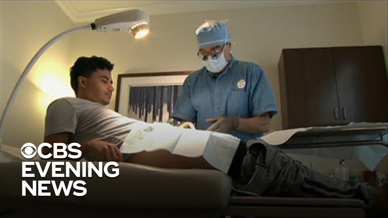 Vasectomy requests increase after Roe v. Wade ruling