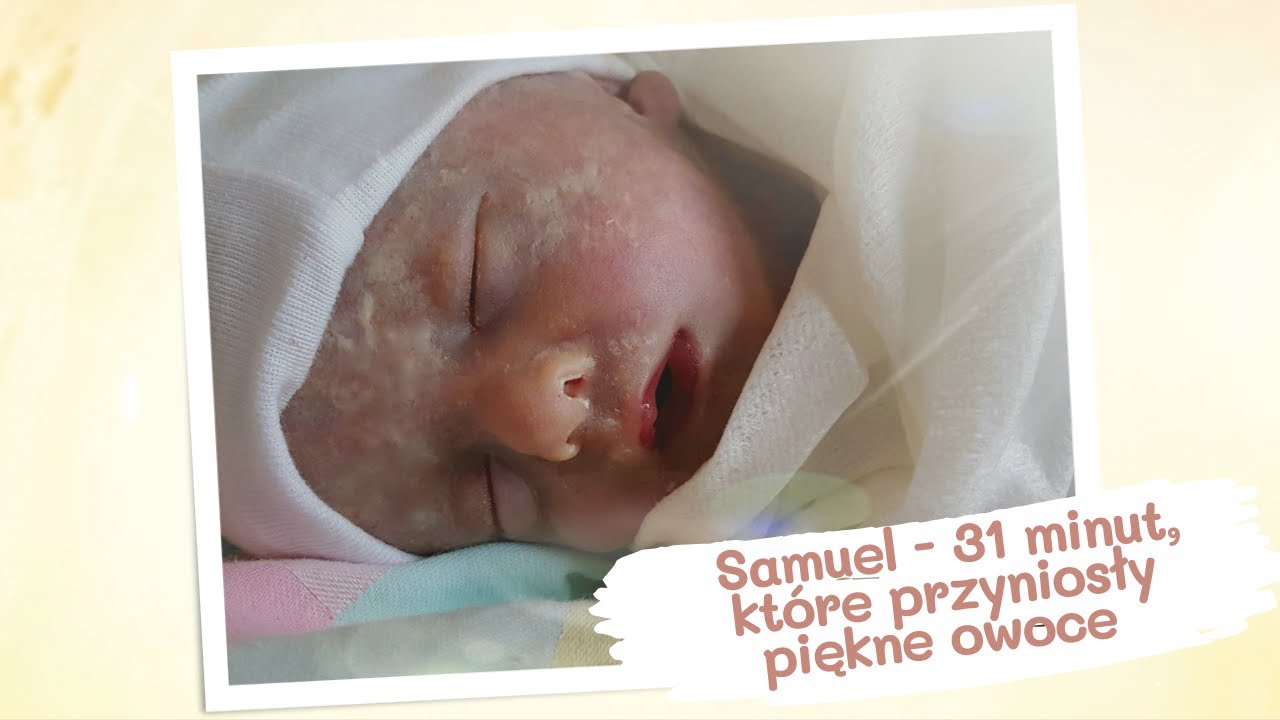 Samuel  - 31 minut, kt&oacute;re przyniosły piękne owoce