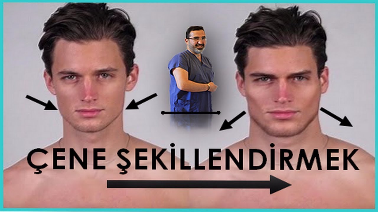 Çene Köşelerinin Belirginleştirilmesi