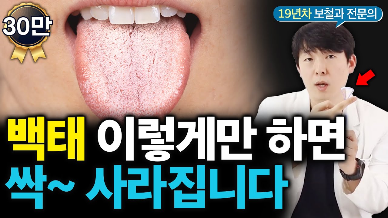 당신만 몰랐던 혀에 백태 생기는 원인! 한번에 없애는 방법은?