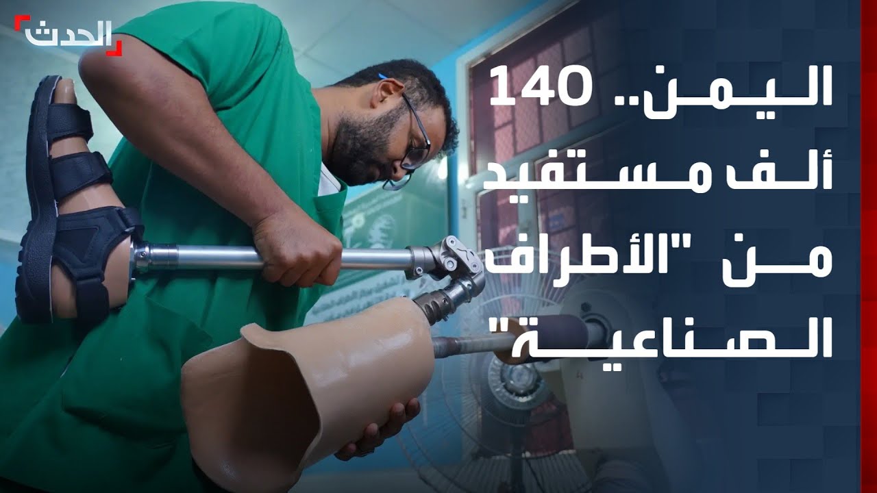 مراسل الحدث: 140 ألف مستفيد من خدمات الأطراف الصناعية والعلاج الطبيعي في اليمن