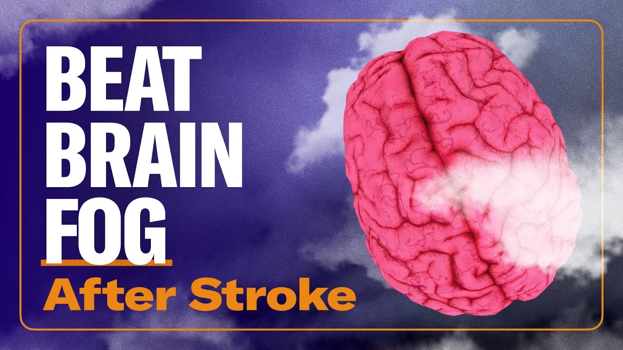Beat Brain Fog & Think Better After Stroke – 5 Practical Tips from an OT