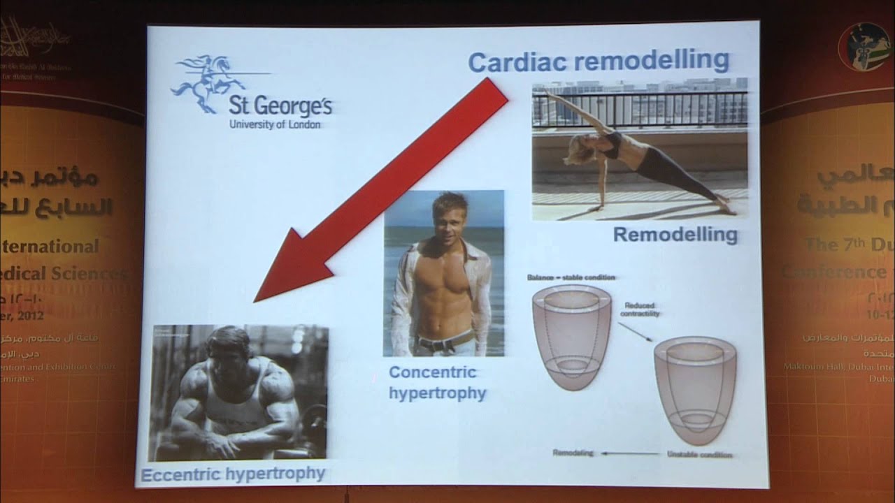 Prof Baskaran Thilaganathan, UK, preeclampsia and maternal cardiac function