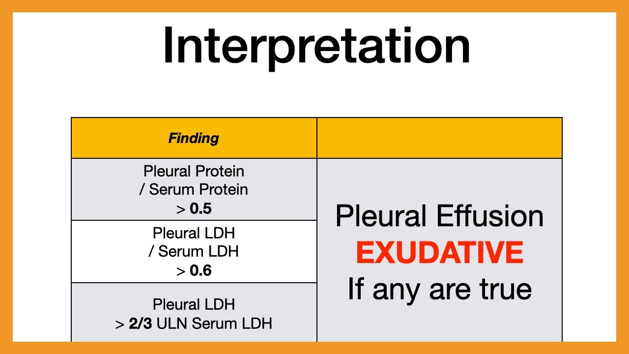 Light's Criteria