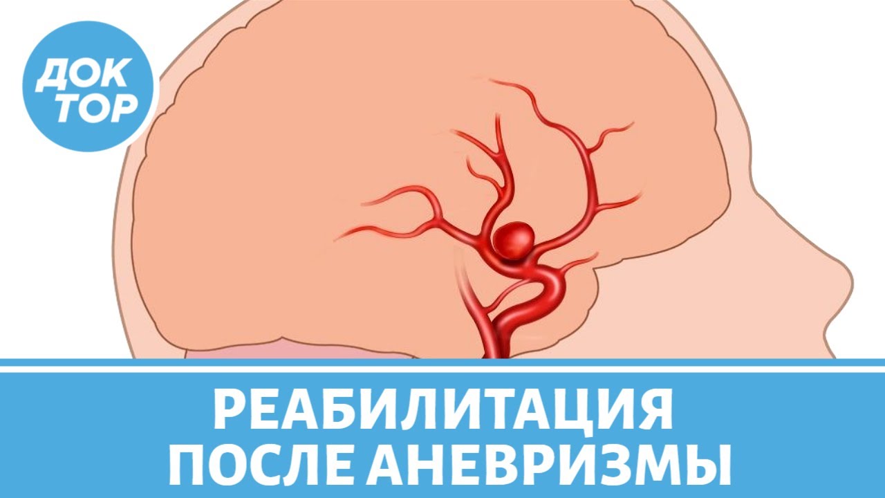 Аневризма головного мозга: как вернуть психическое здоровье?