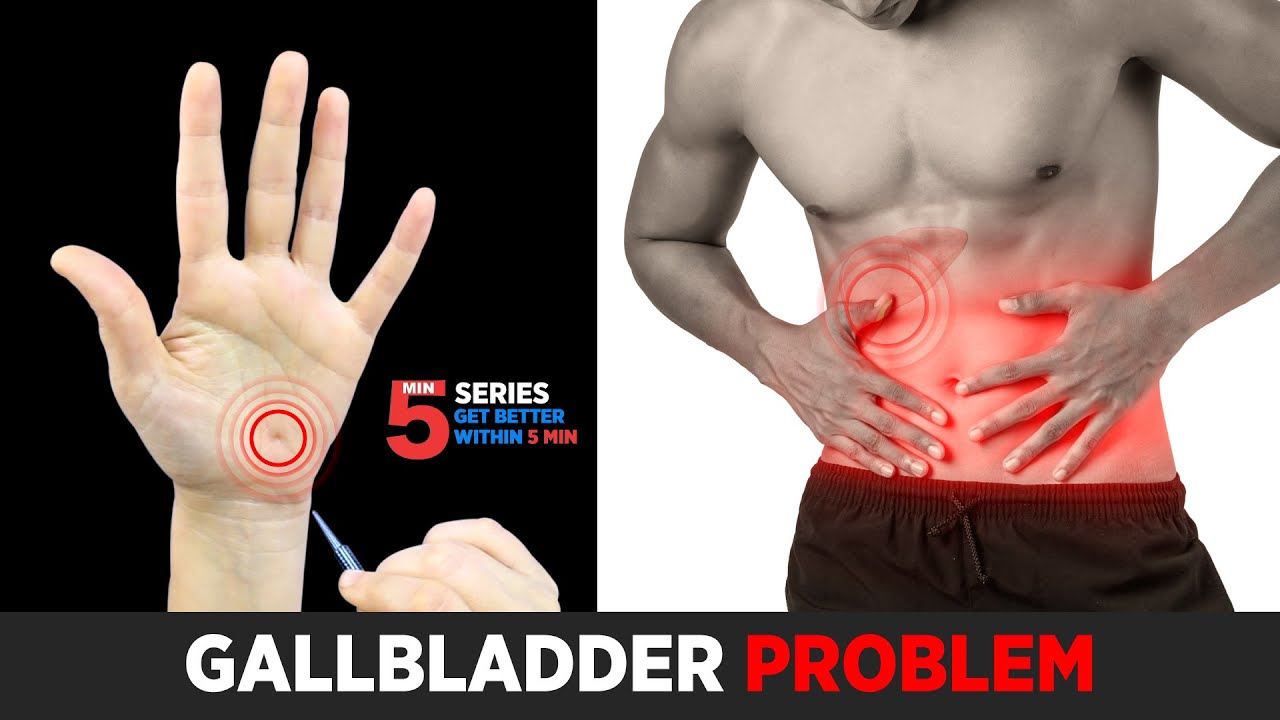 SUJOK TREATMENT FOR GALLBLADDER PROBLEMS🔥💥