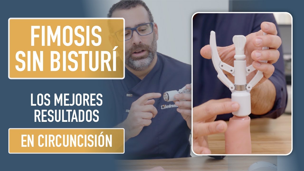 Circuncisión sin bisturí. Cirugía Fimosis. Mejores resultados. Dr. Rodrigo García-Baquero. Andromedi