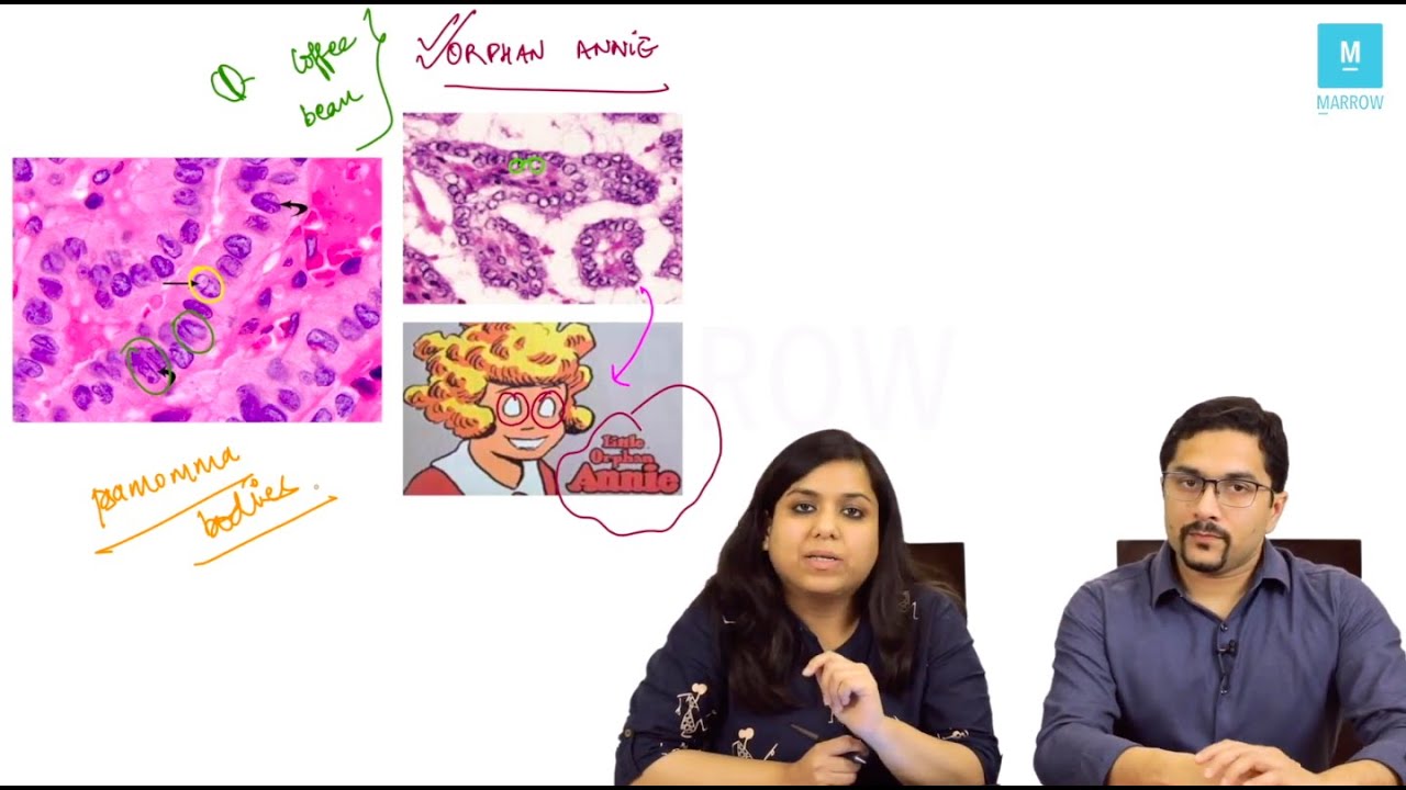 Patient with a neck swelling: Surgery - Pathology integrated discussion