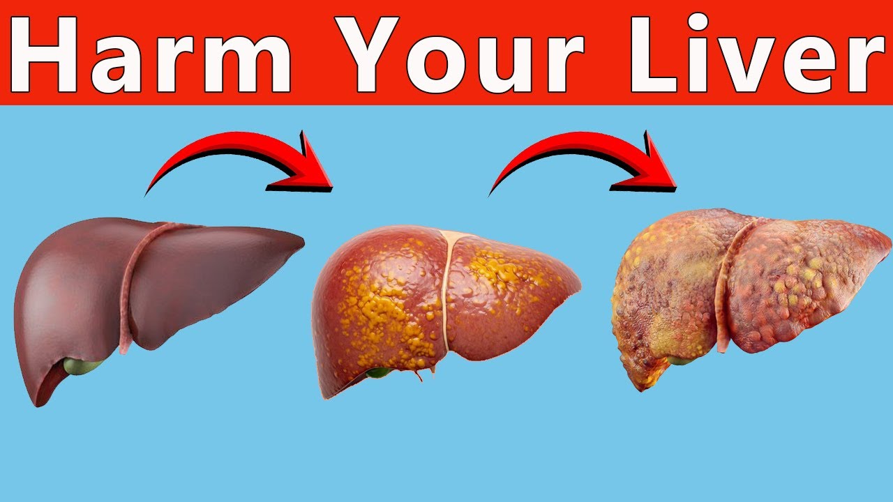 Think Herbal Supplements Are Safe? These Can Harm Your Liver