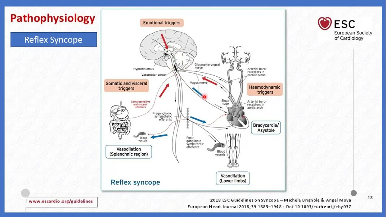 Syncope - Prof. Waleed Ammar