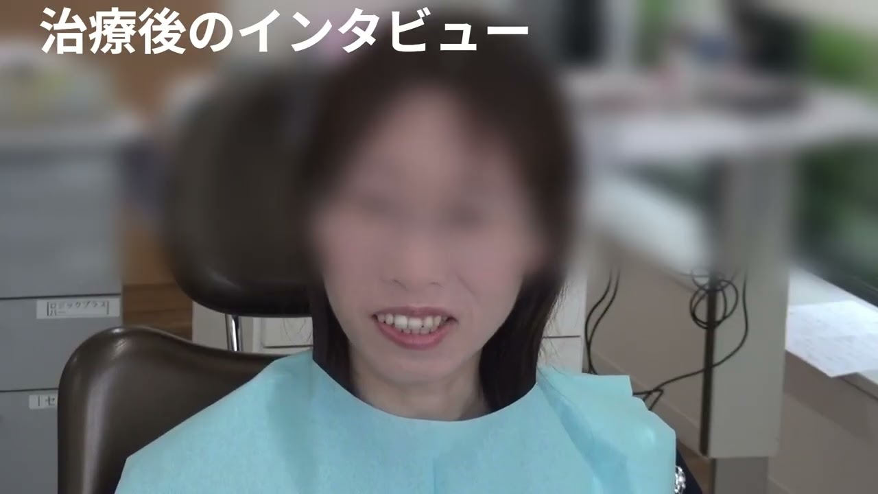 顎関節症を「噛み合わせ矯正歯科治療」で治す！＃噛み合わせ＃顎関節症＃矯正歯科＃歯医者＃入れ歯