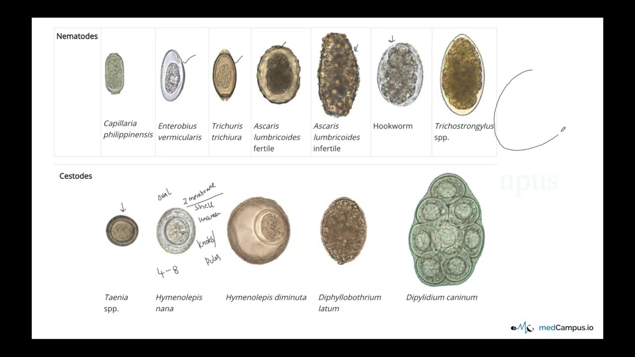 Eggs in parasitology | How to Identify | Explained in detail | spotters