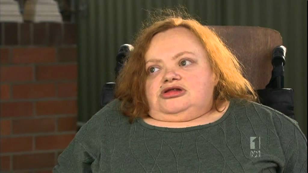 ABC Federal Government Disability Insurance Scheme 26072012