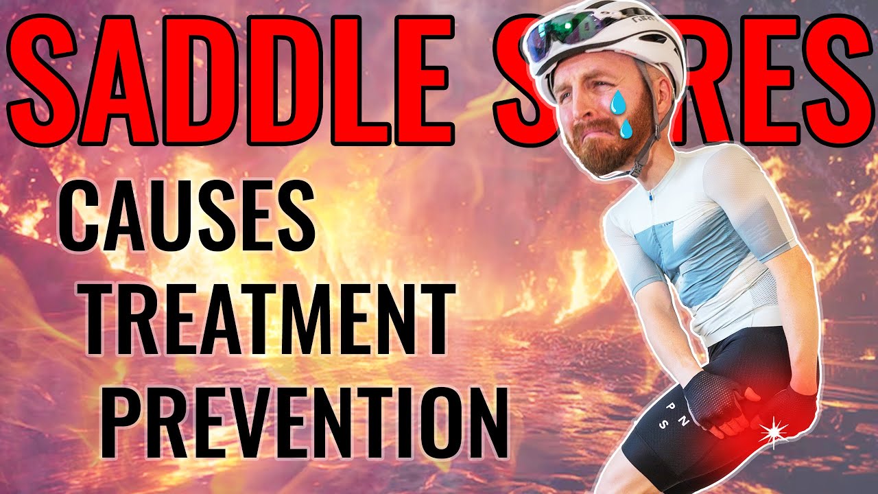 Saddle Sores - Causes, Treatments & Preventions. A Deep Dive Into The Cyclist's Nemesis