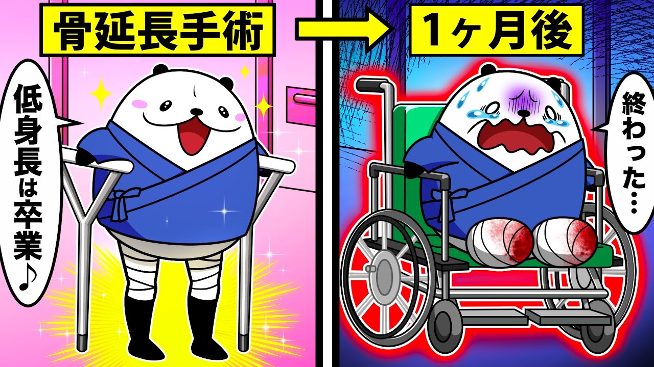 低身長とバカにされて骨延長手術をした男の末路がやばすぎる【アニメ】