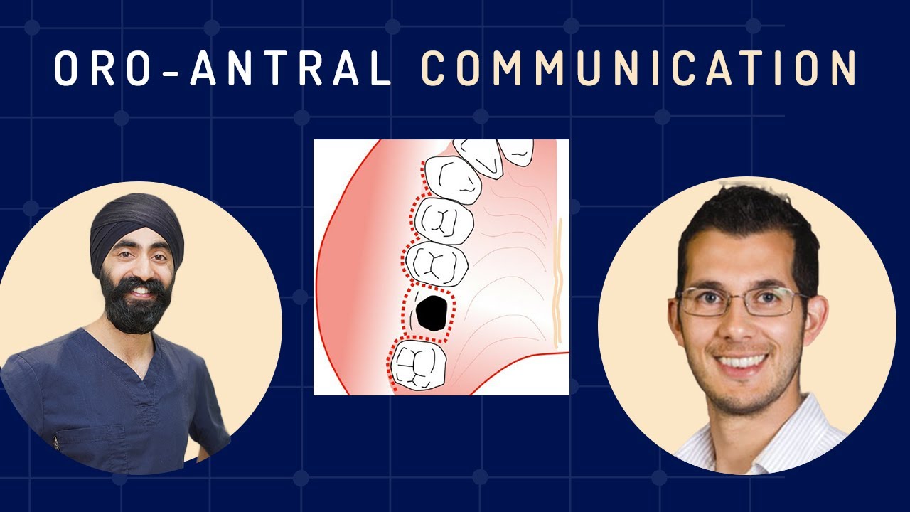 Oro Antral Communication Management - GF011