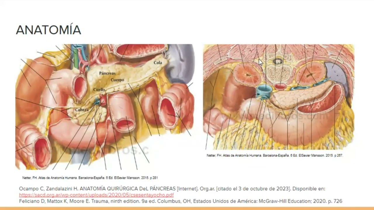 Trauma pancre&aacute;tico - Hospital Universitario San Vicente Fundaci&oacute;n
