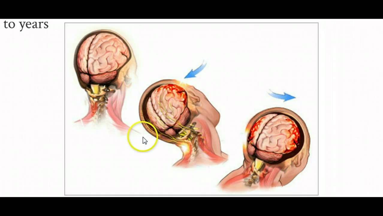 Aging Related and Cognitive Disorders