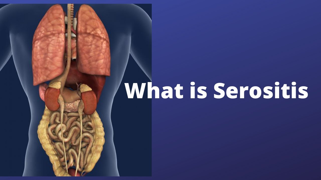 What is Serositis