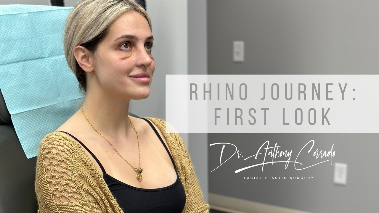 Victoria's Rhinoplasty Journey (Part 2) - Emotional 1-Week Reveal | Dr. Anthony Corrado