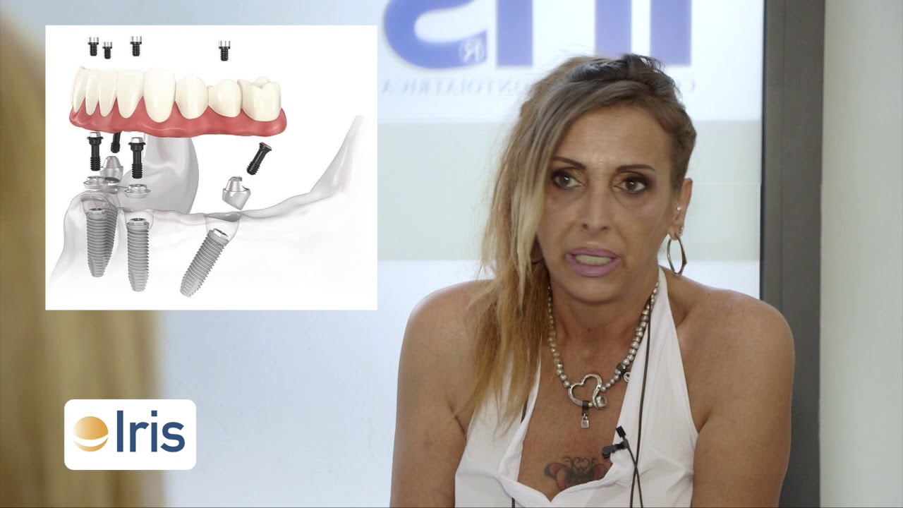 IN CROAZIA DENTIERA, IN IRIS DENTI FISSI: la storia di Antonella