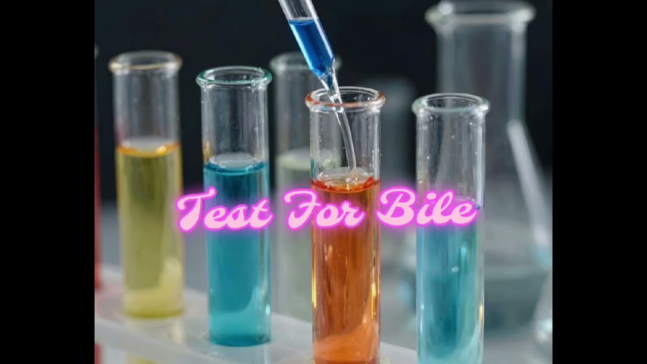 Test For Bile# Urine Sample*11