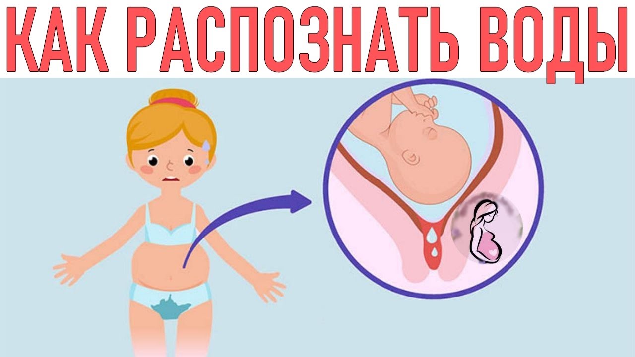 ОКОЛОПЛОДНЫЕ ВОДЫ ВО ВРЕМЯ БЕРЕМЕННОСТИ | Как выглядят околоплодные воды и как их распознать