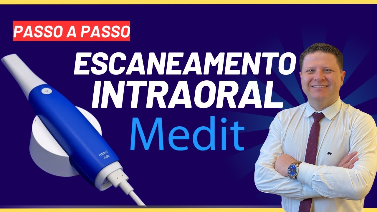 ESCANEAMENTO INTRAORAL COM MEDIT i600