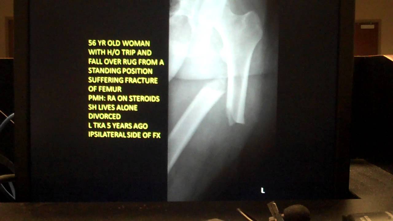 Bisphosphonates and the orthopaedic surgeon