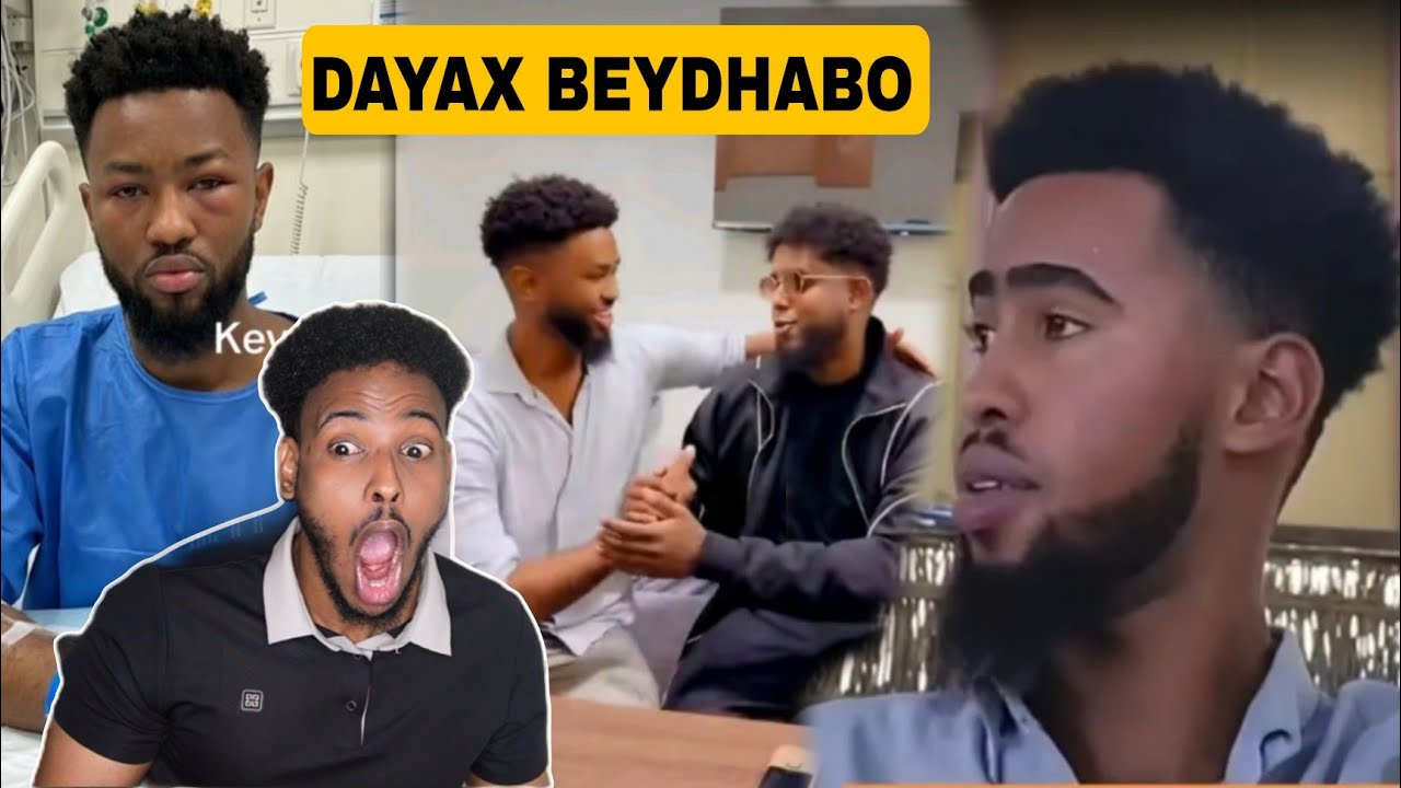 Daawo Dayax Beydhabo oo Sixun u Karbashay Dayax Dalnuurshe Dagaalkii CK iyo Dayax....
