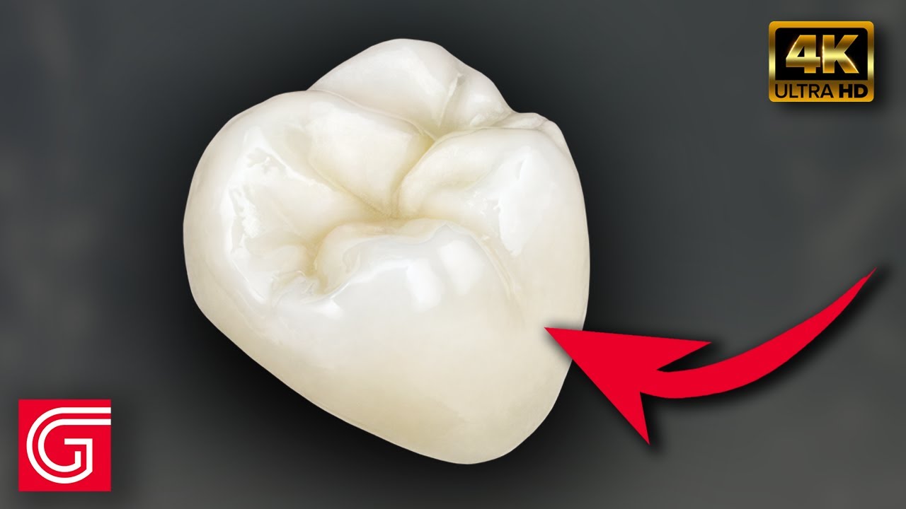 What Makes BruxZir® so Strong?
