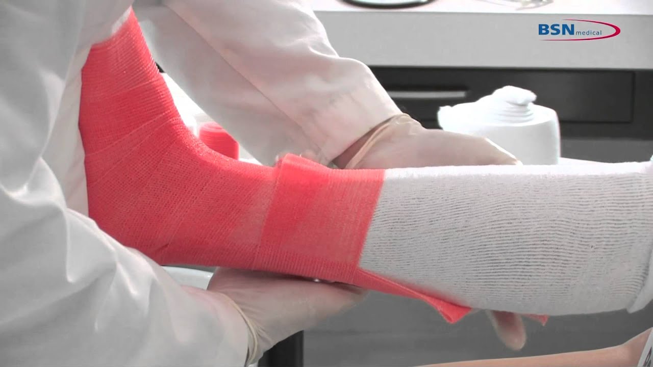 Plâtre synthétique Application amovible sur le bas de la jambe_FR_de BSN medical.mov