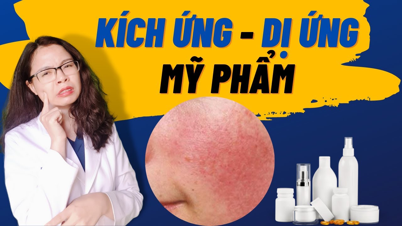 Da bị kích ứng - Dị ứng mỹ phẩm làm sao hết ? - Bác sĩ Nguyên
