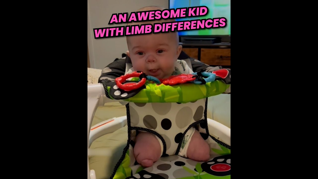 An Awesome Kid With Limb Differences ❤️ | OKAY REALLY