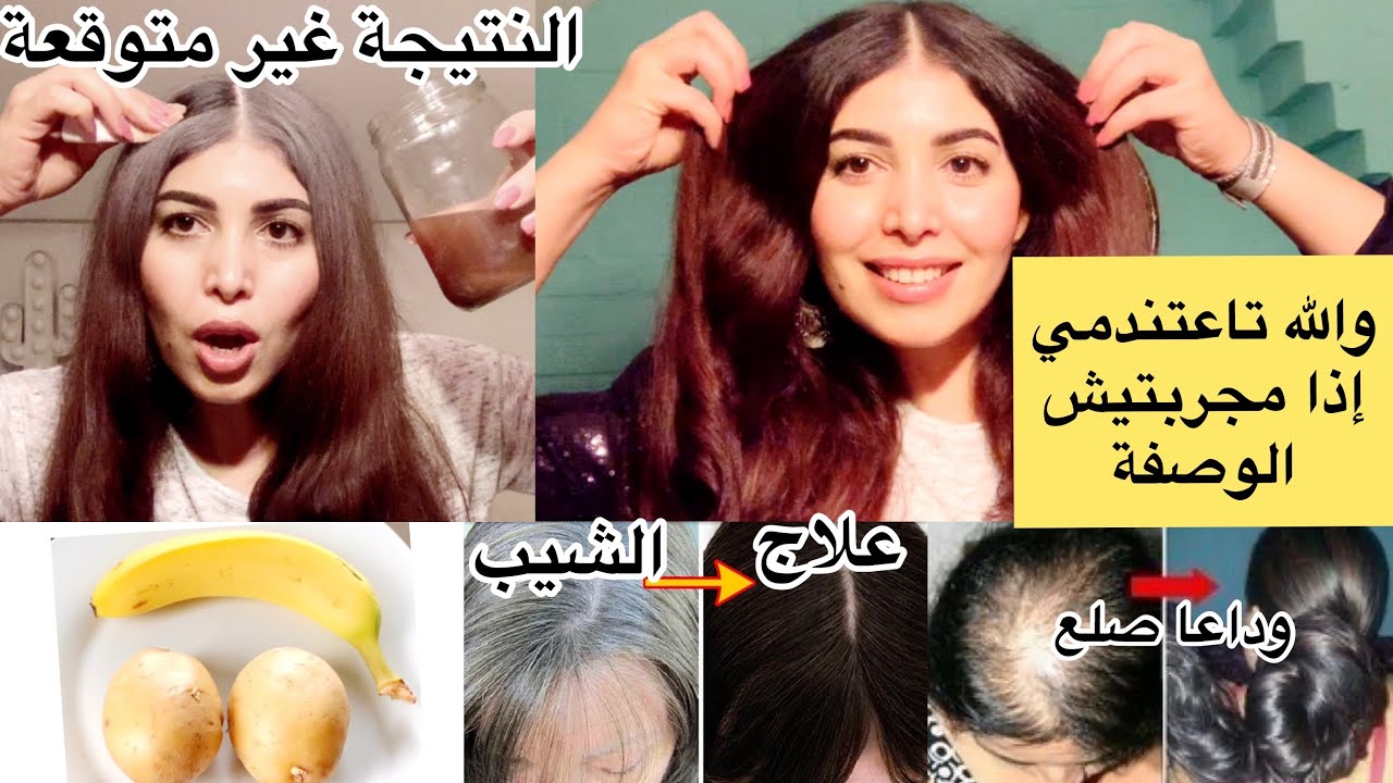 تخلصي نهائيا من الشيب بقشور الموز والبطاطس/علاج الصلع والتساقط المزمن/تطويل شعر وتكثيفه بسرعة