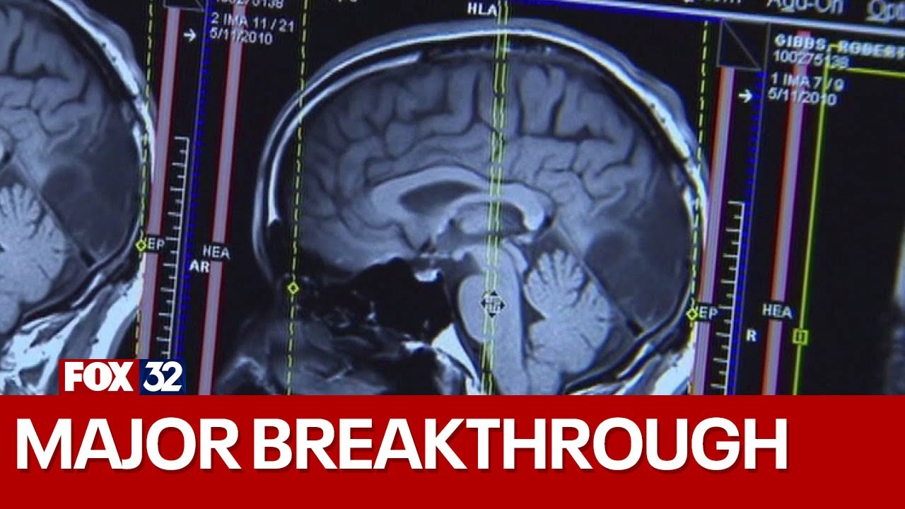 Northwestern Medicine achieves breakthrough in brain cancer treatment
