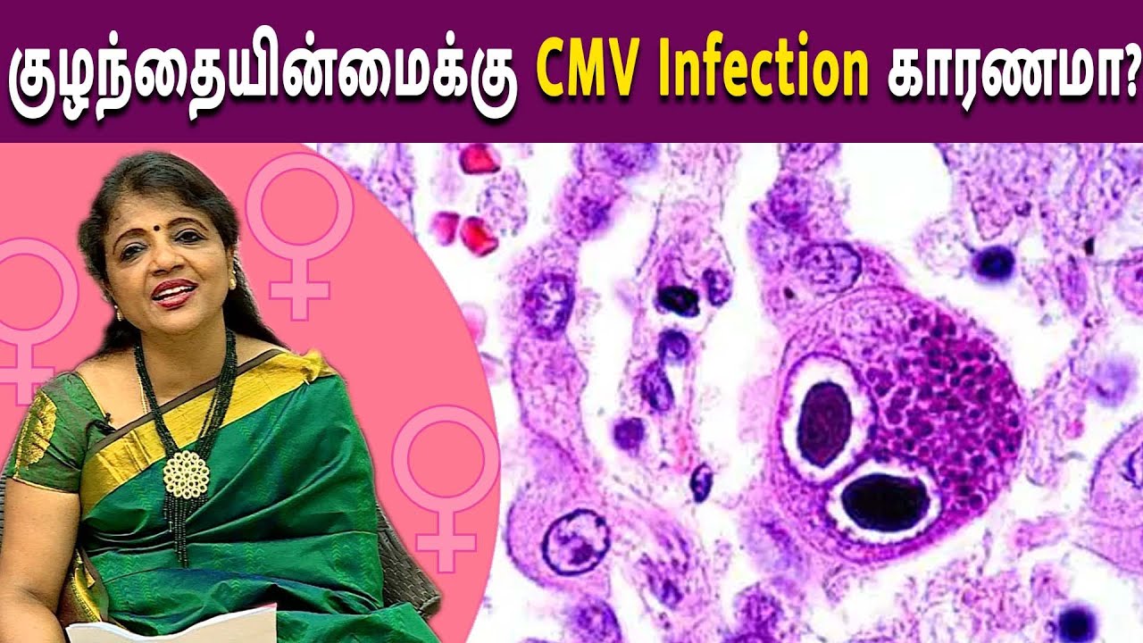 குழந்தையின்மைக்கு CMV Infection காரணமா? | Magalir Nalam | Dr Jayarani