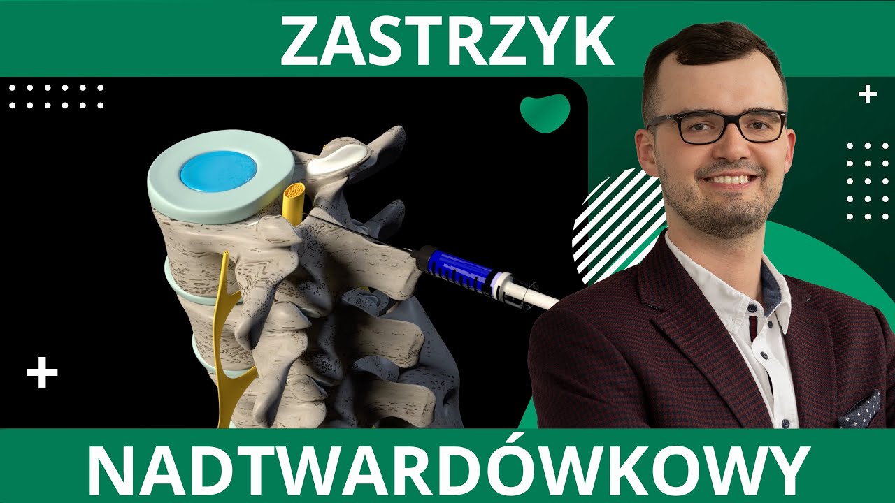 Zastrzyk nadtwardówkowy - czym jest blokada kręgosłupa? Korzyści dla pacjenta, przeciwskazania