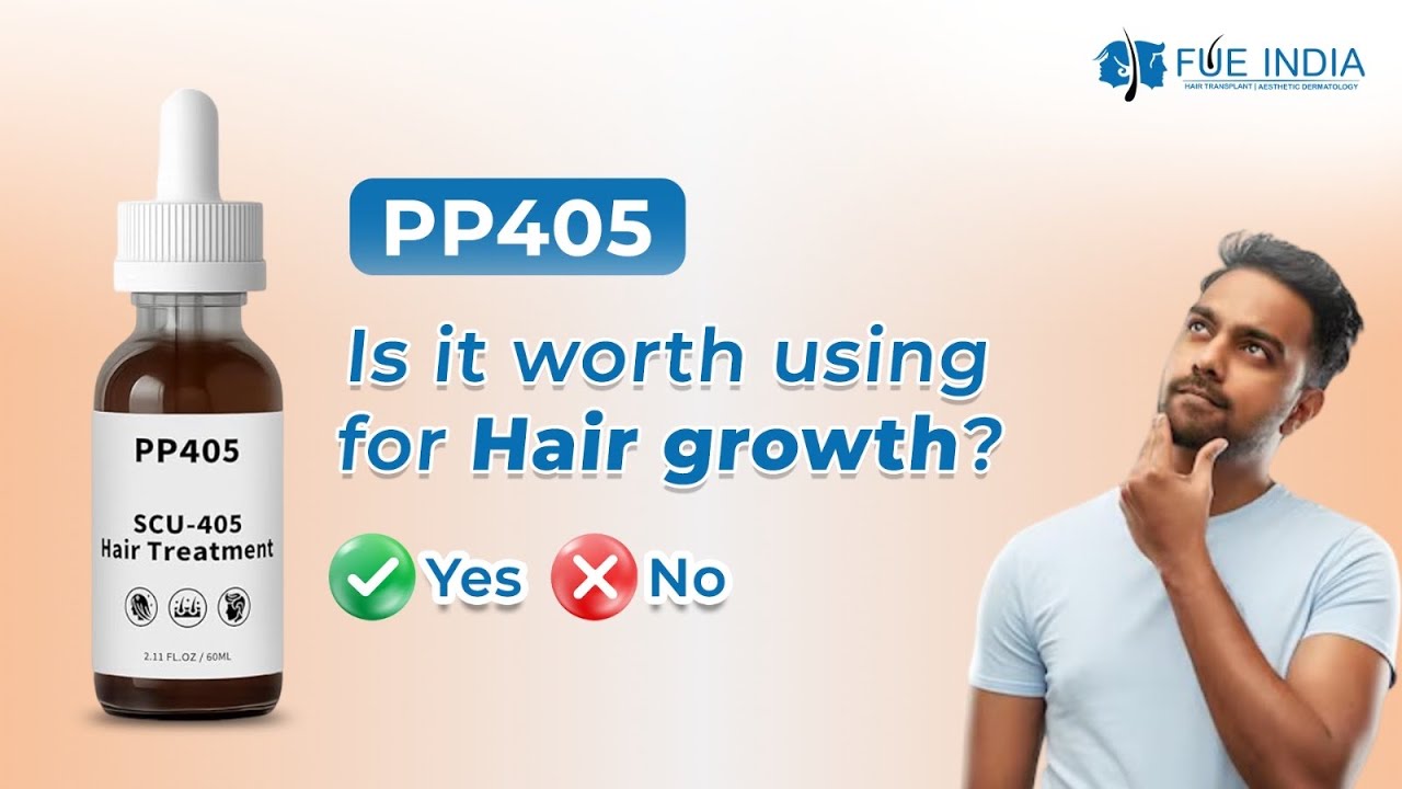 PP405 for Hair Fall: Does It Really Work? | A Surgeon's Guide