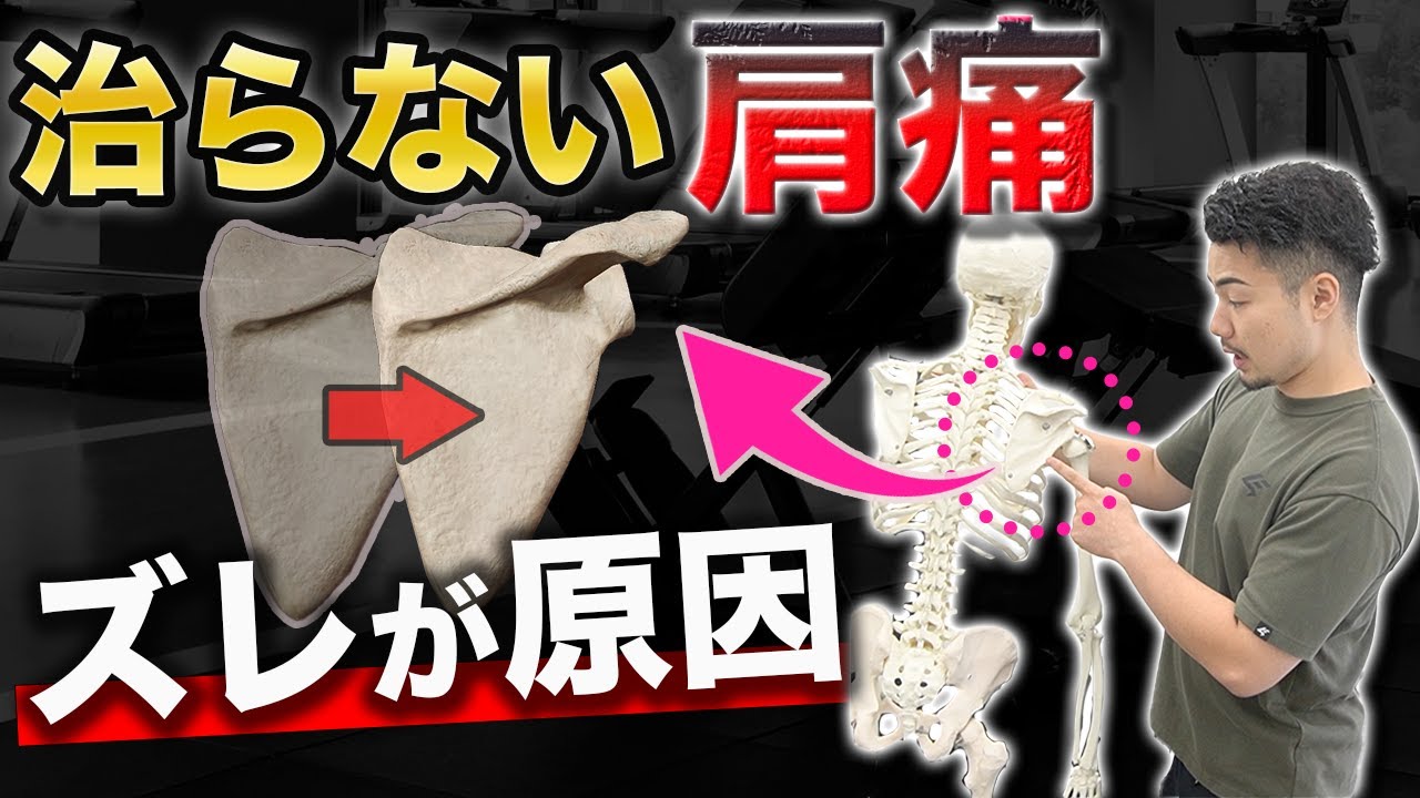 【巻き肩と肩甲骨のズレ】いつまでも肩の痛みが治らない理由と改善方法