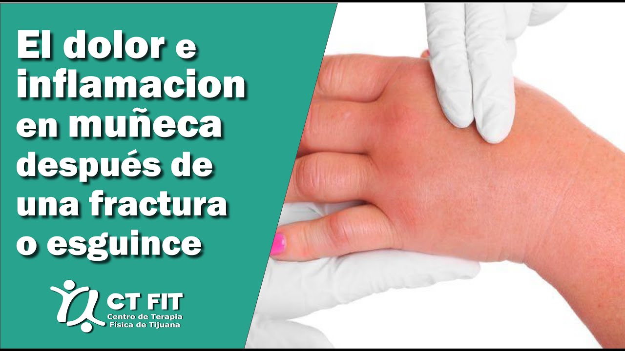 Dolor e inflamación de muñeca después de una fractura o esguince | Centro de Terapia Física Tijuana