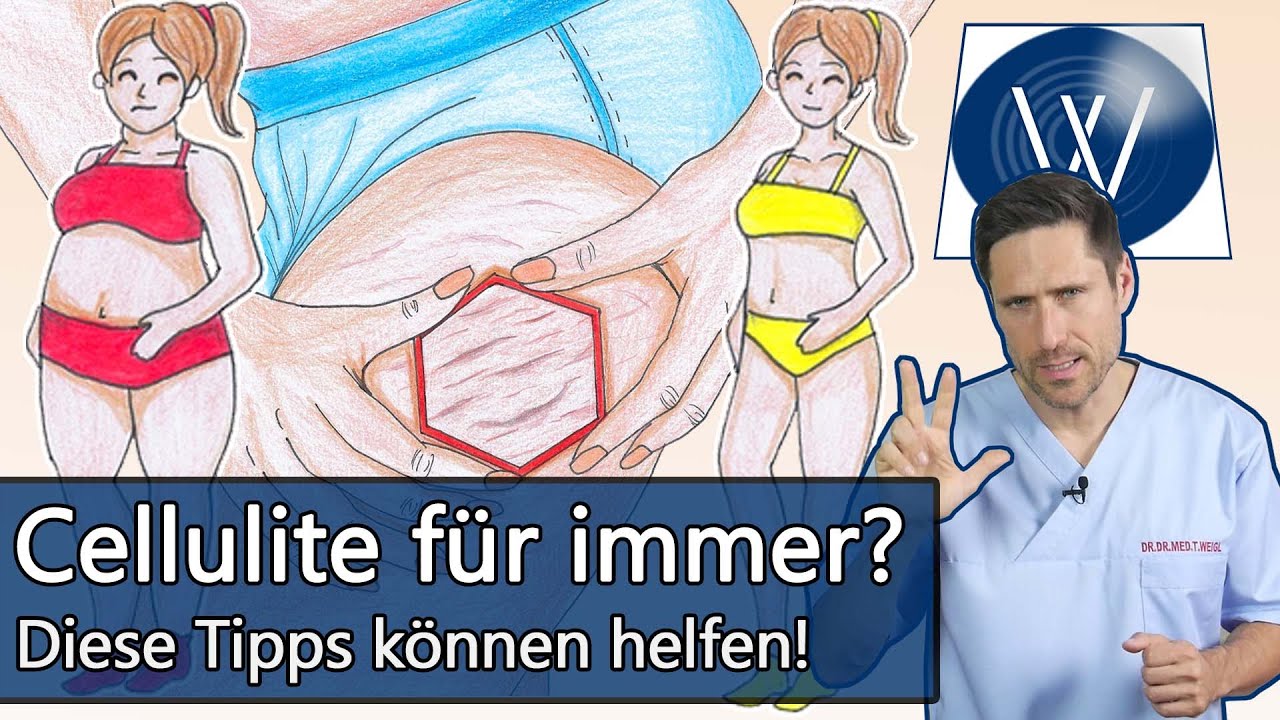 Cellulite bek&auml;mpfen & Bindegewebe straffen: Einfluss von Stoffwechsel, Ern&auml;hrung und Durchblutung!