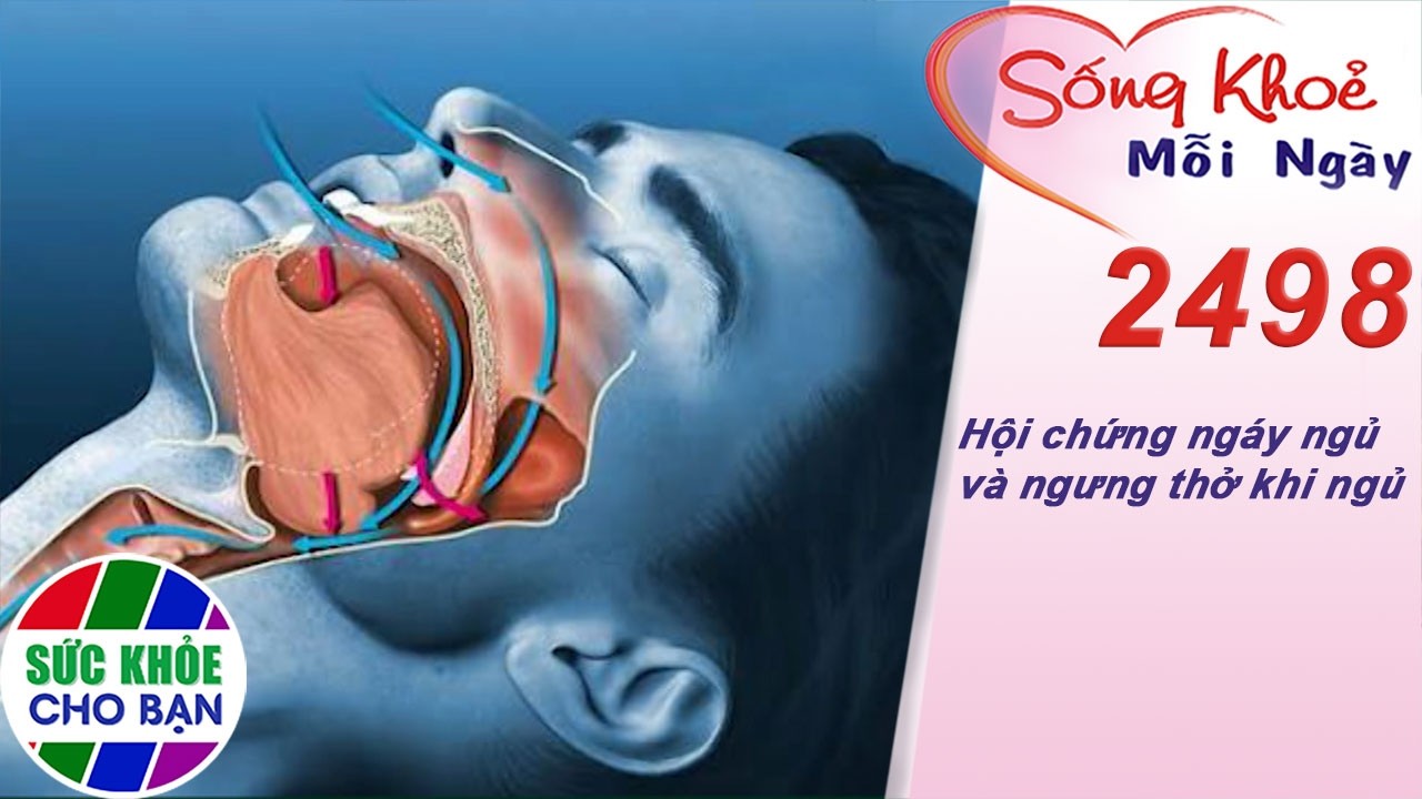 Hội chứng ngáy ngủ và ngưng thở khi ngủ | Sống khỏe mỗi ngày – Kỳ 2498