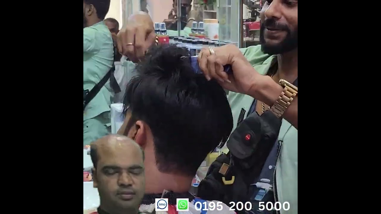 Hair Replacement In Bangladesh / টাক সমস্যা সমাধান / নন-সার্জিক্যাল পদ্ধতিতে টাক সমাধান