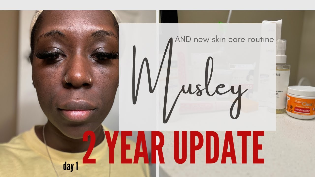 ✨ The End of My Musely Journey — 2 Years Later! ✨| Is it Worth it? | New Skin Care Routine