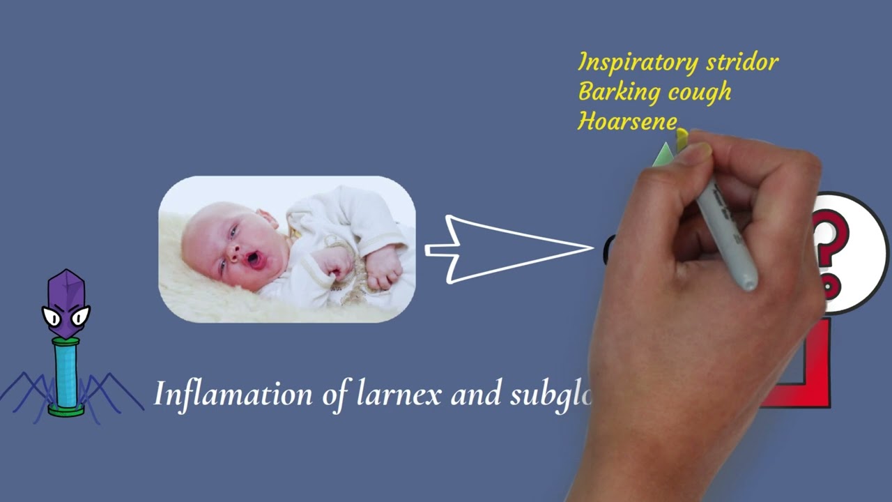 croup/ في دقيقتين اعرف ازاي تتعامل مع اخطر حالة في استقبال الاطفال